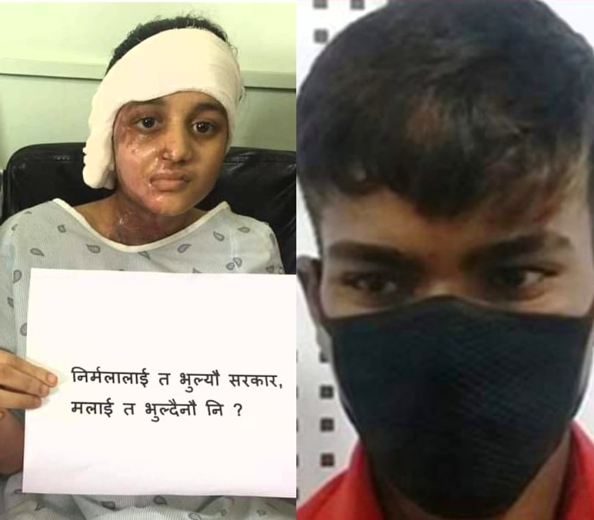 यसरी छुटे बिरगञ्जकी मुस्कानलाई एसिड छ्याप्ने अभियुक्त